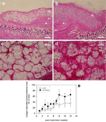  Lactic Acid: Osteogenic Potential and Biocompatibility in Tissue Engineering Applications!